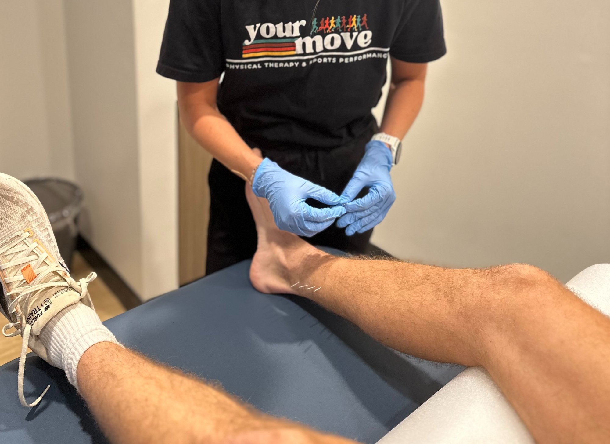 dry needling PT